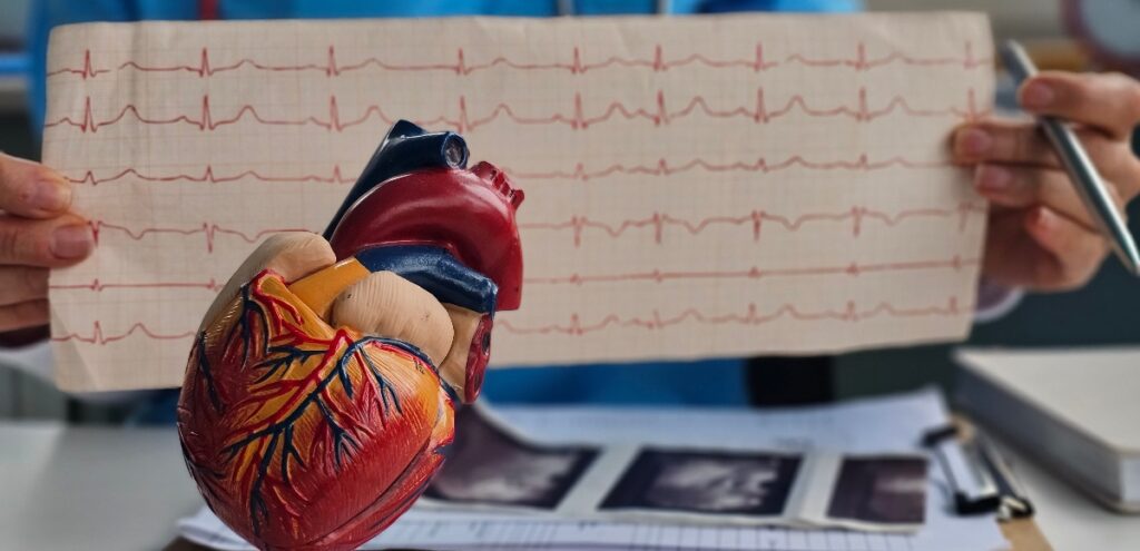 angina pectoris