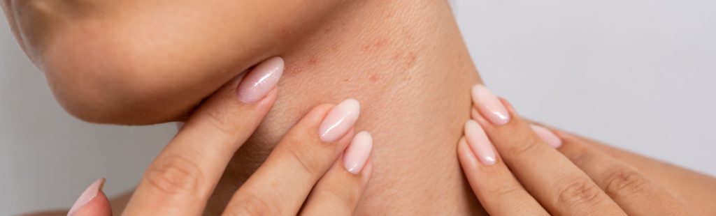 dermatologia