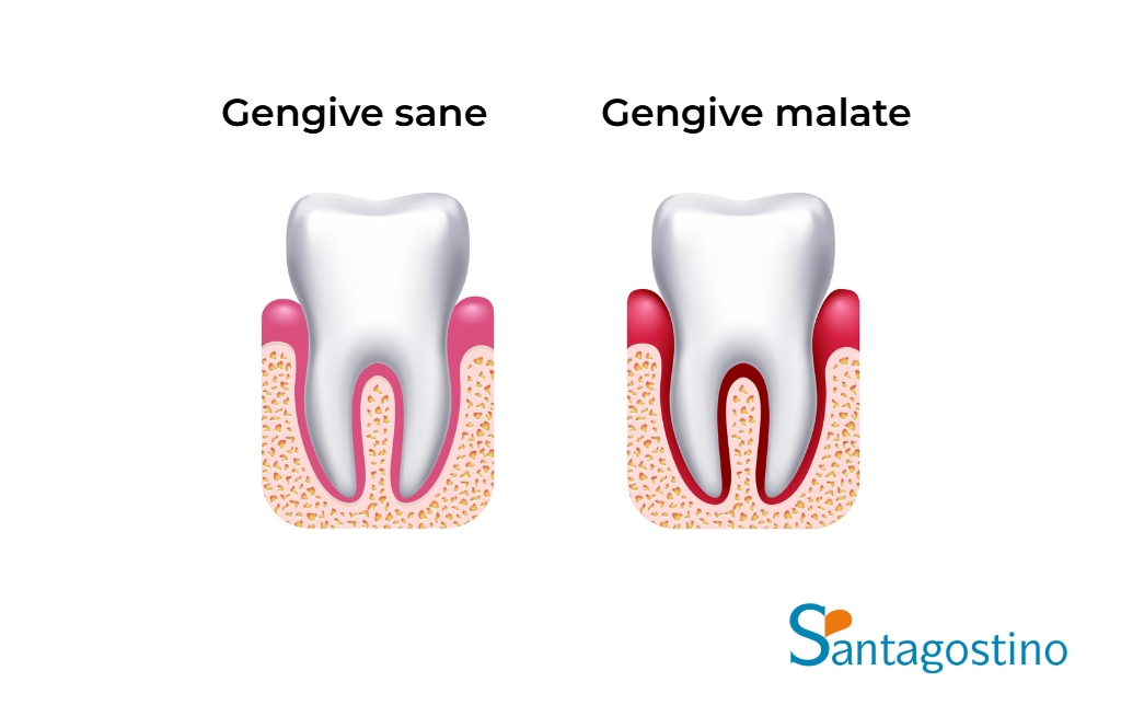 Gengive sane malate santagostino busto arsizio