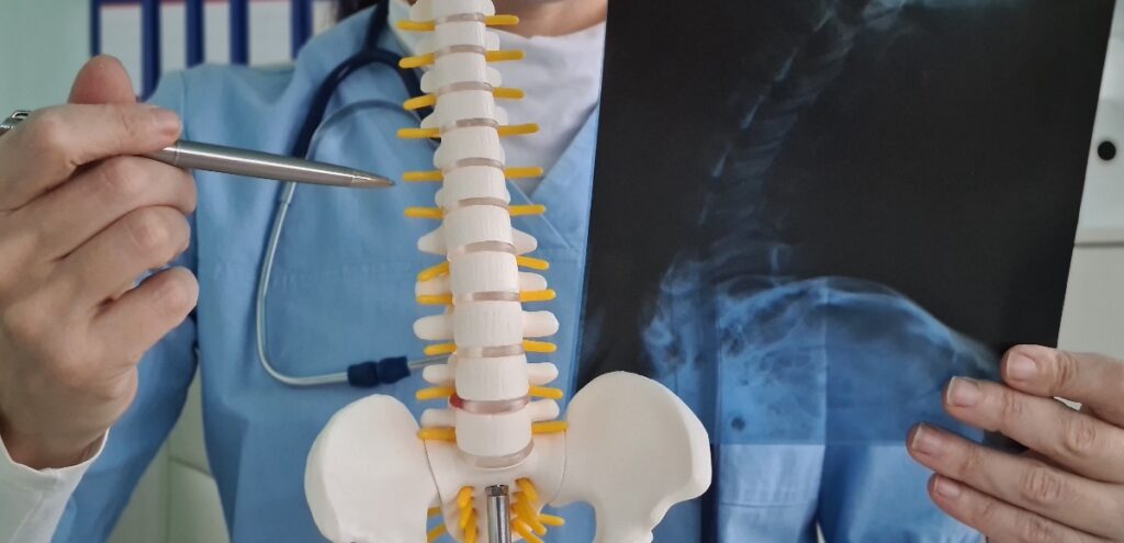 lombalgia o mal di schiena