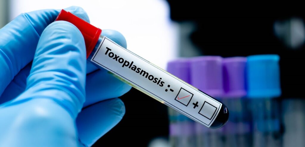 toxoplasmosi