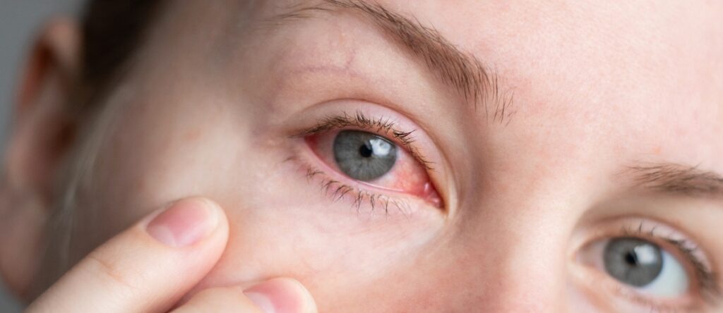 Lavaggio vie lacrimali santagostino busto arsizio