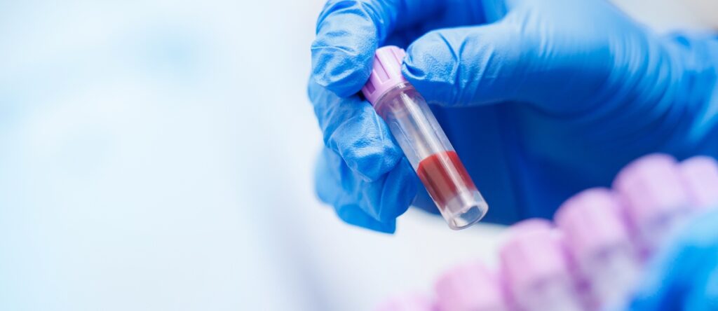 anemia santagostino nembro