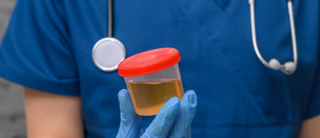 esame urine santagostino busto arsizio