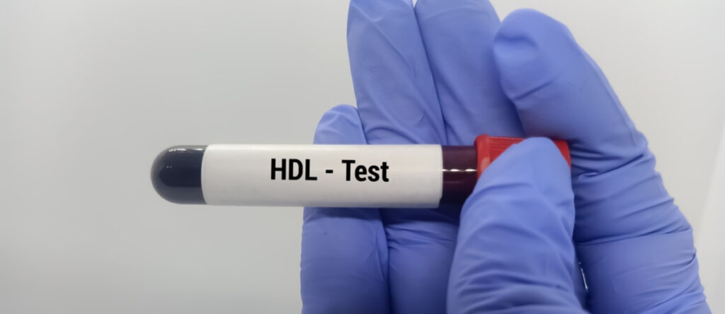 colesterolo hdl santagostino genova