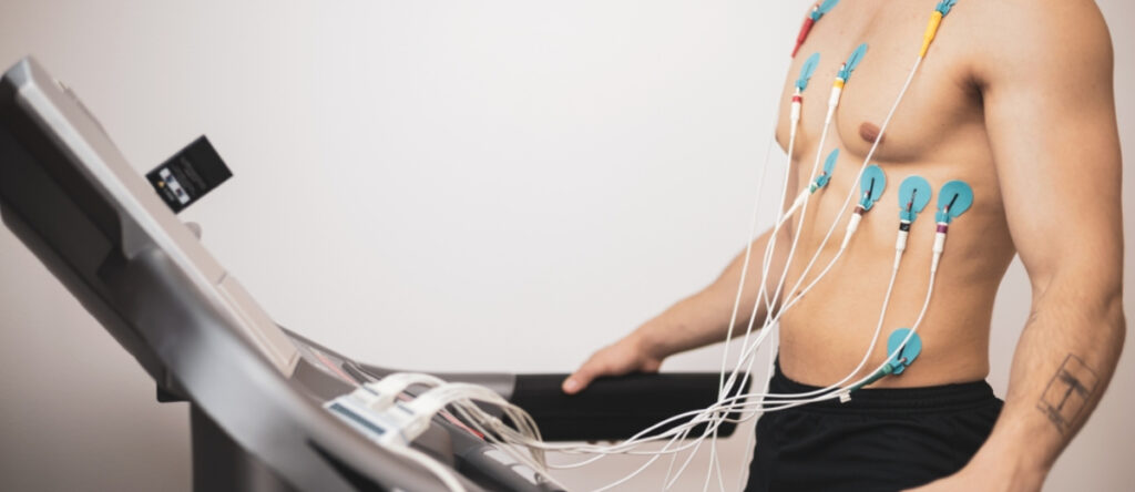 test sotto sforzo santagostino busto arsizio