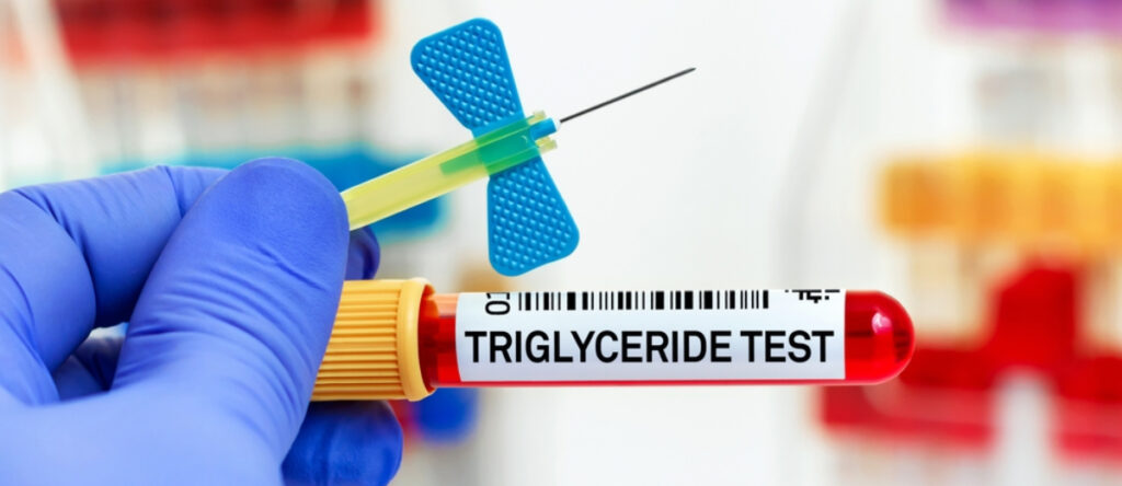 trigliceridi santagostino busto arsizio