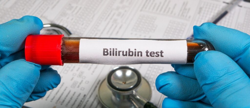 bilirubina santagostino busto arsizio