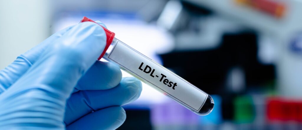 colesterolo ldl santagostino busto arsizio