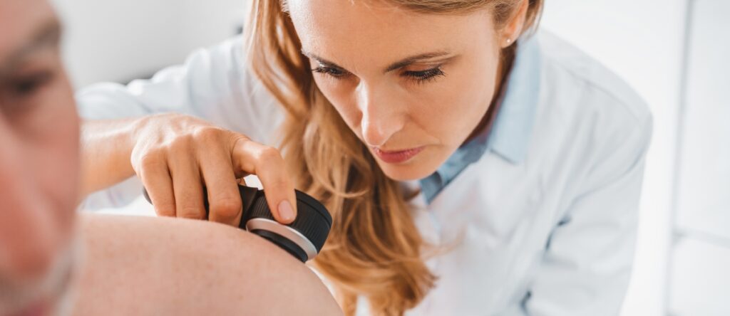 melanoma santagostino busto arsizio
