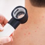 visita dermatologica