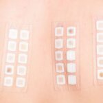 patch test busto arsizio