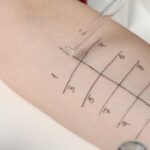 prick test busto arsizio